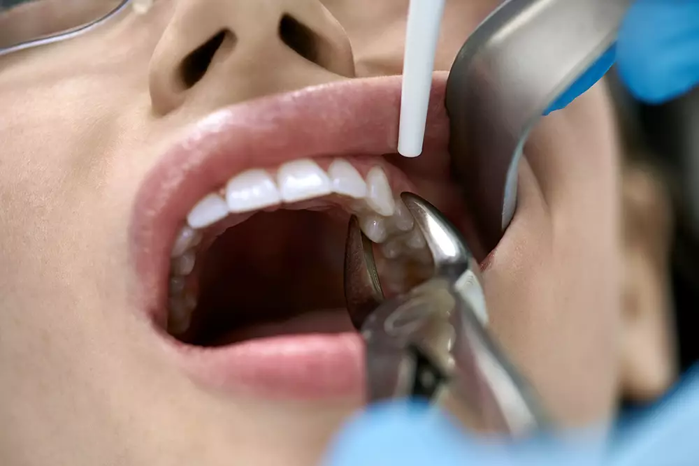woman's tooth extraction treatment in dental clinic