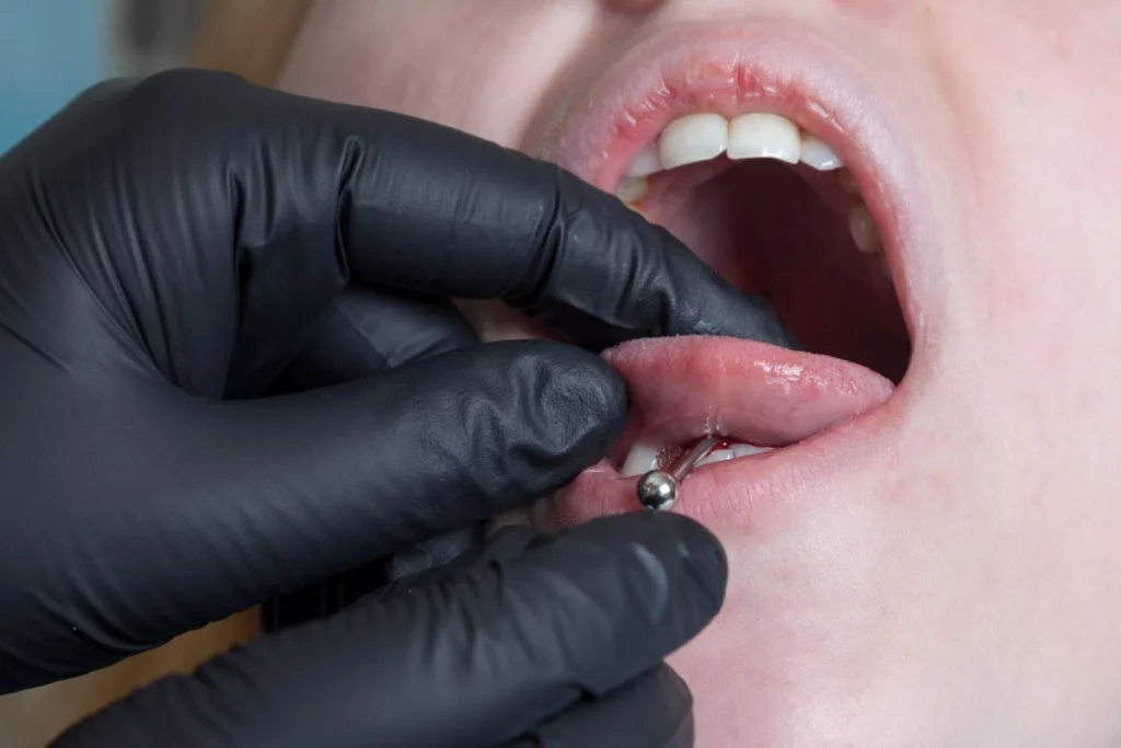 Oral Piercing